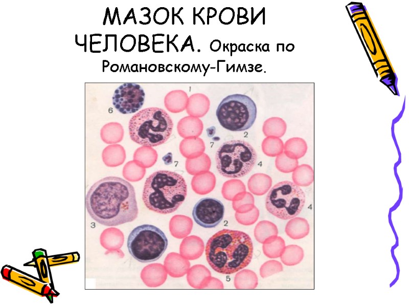 МАЗОК КРОВИ ЧЕЛОВЕКА. Окраска по Романовскому-Гимзе.